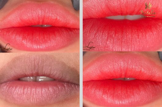 Dịch vụ phun môi Glowlips  | Thế Giới Skin Care